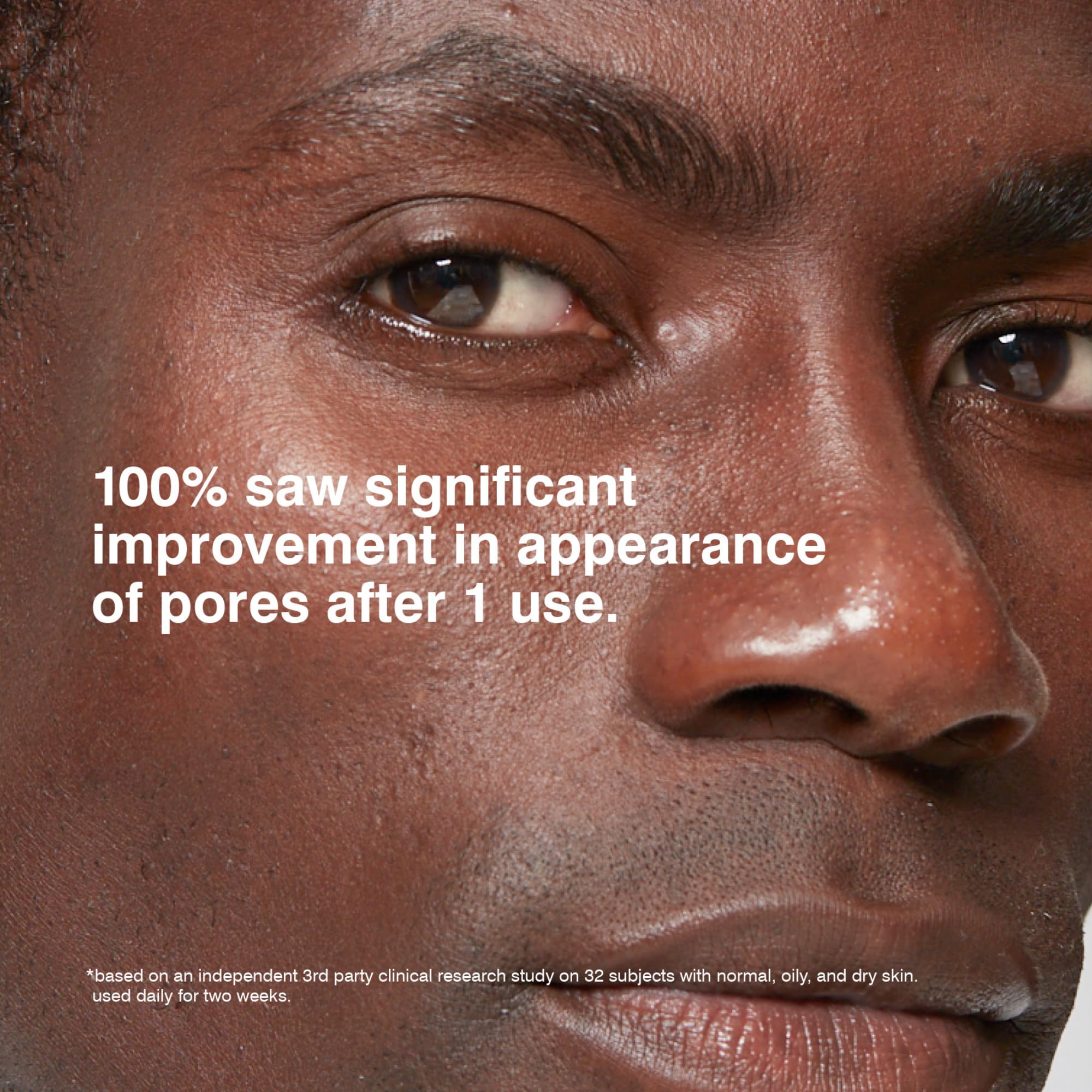 MALIN+GOETZ pore balance preview demonstrates refined look after use.