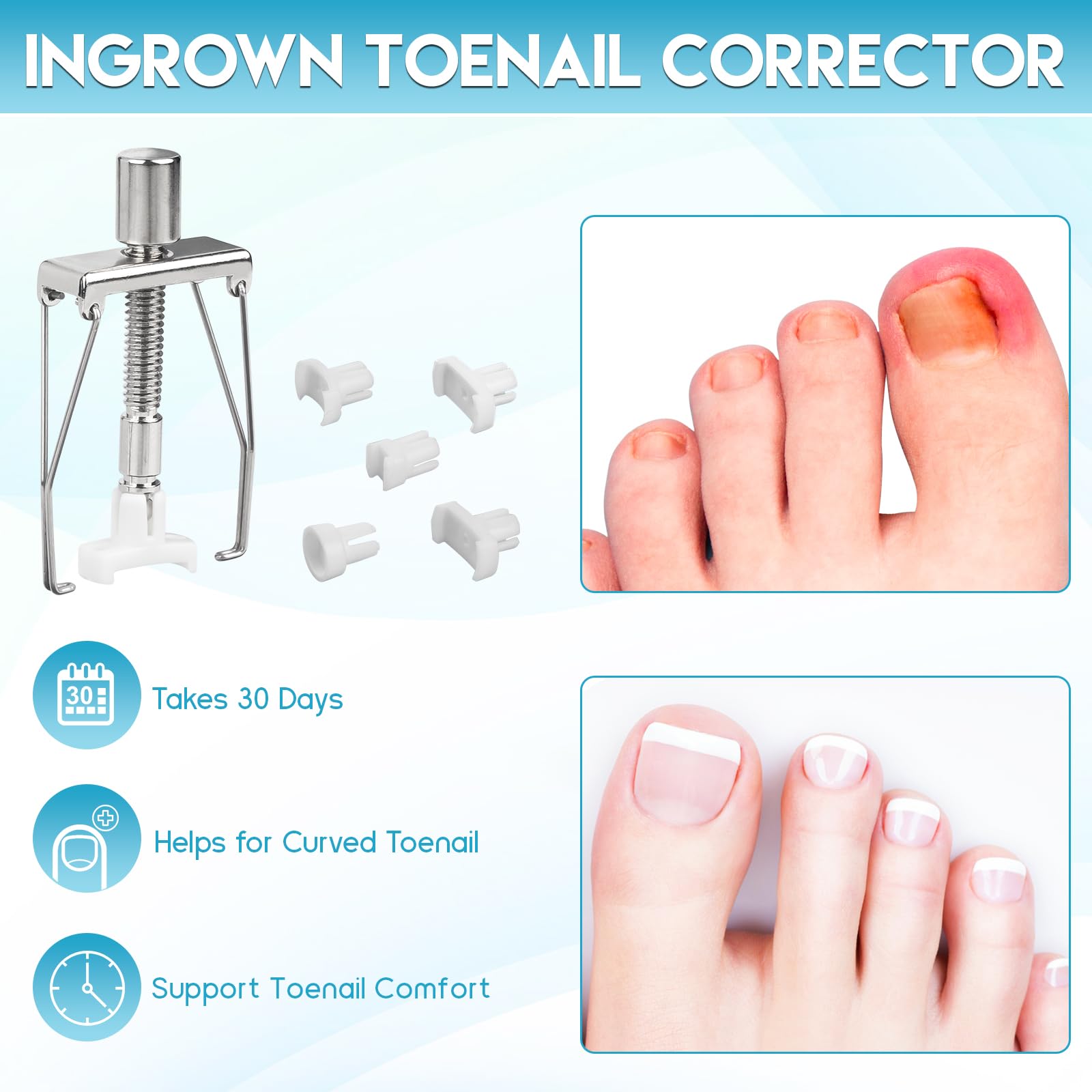 Maliyscent toe protector guards during treatment.