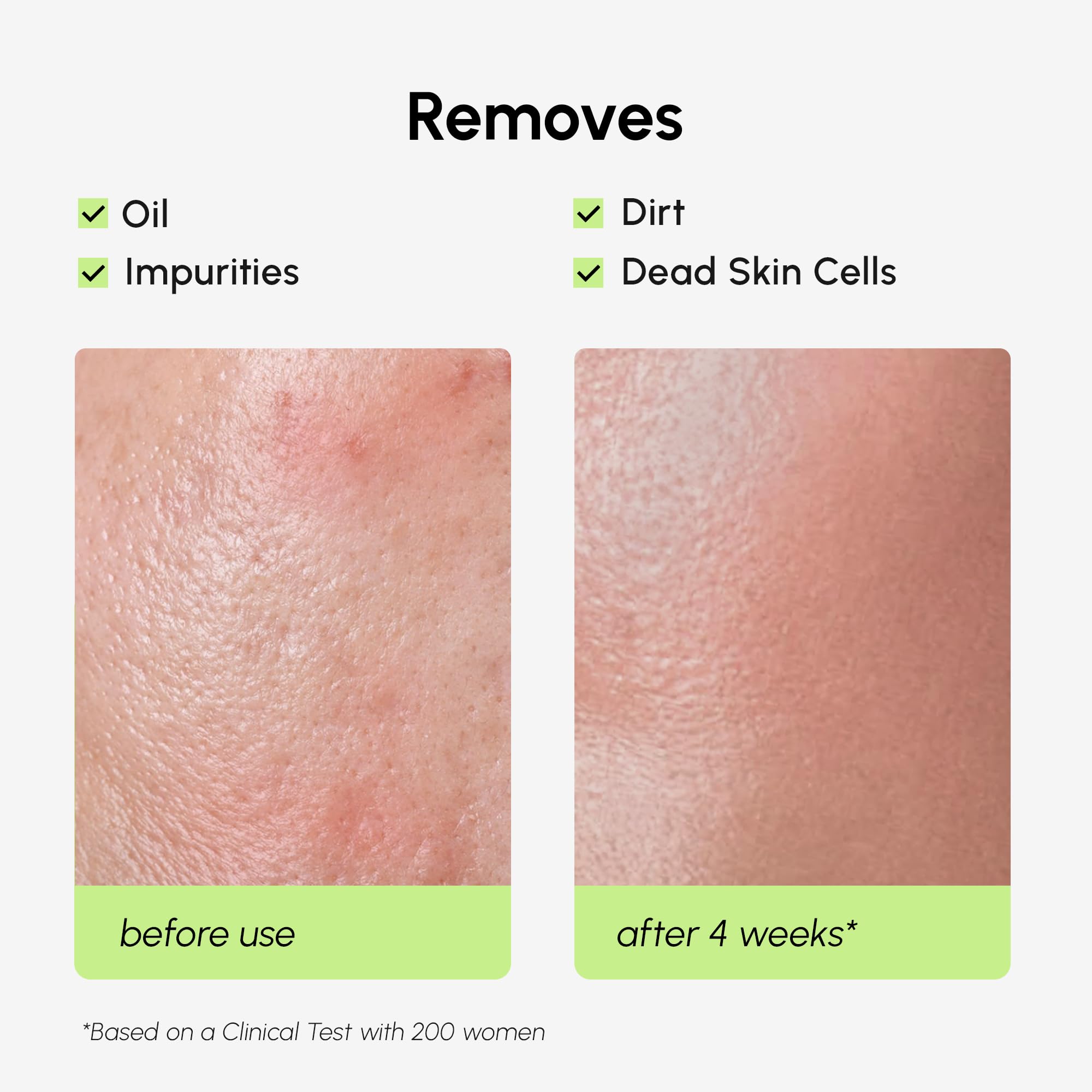 MAREE BHA exfoliant scene suggesting clearer pores and refreshed skin