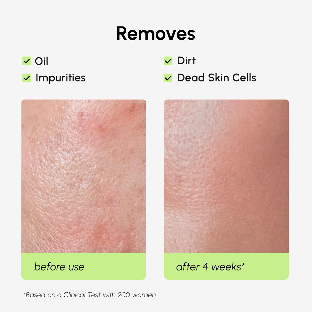 MAREE BHA exfoliant scene suggesting clearer pores and refreshed skin