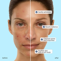 MAREE exfoliante facial colágeno y ácido hialurónico para elasticidad e hidratación