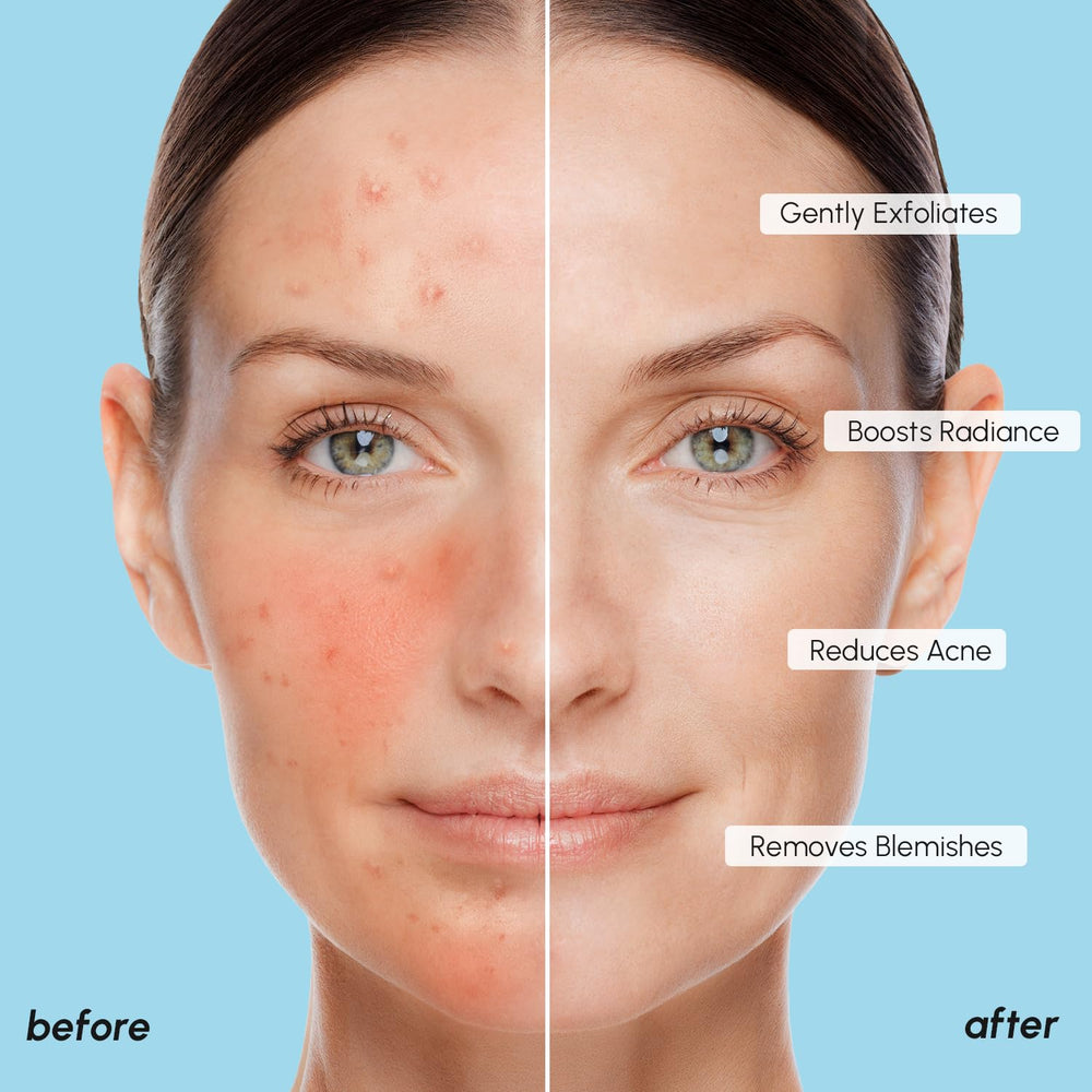 MARÉE pad being applied as part of skincare routine