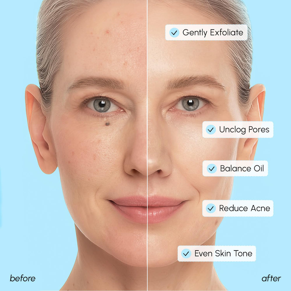 MAREE Glycolic pads close-up label highlights hyaluronic and niacinamide ingredients.