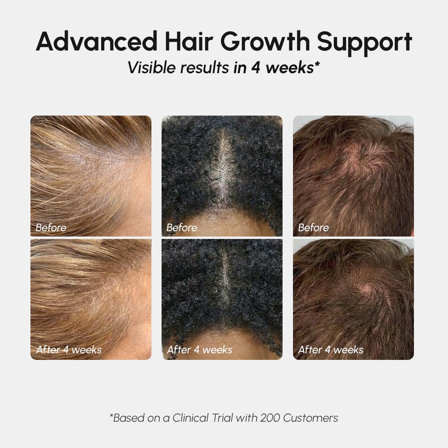 MAREE Hair Growth Spray ingredients label highlights caffeine and rosemary.