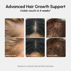 MAREE Hair Growth Spray ingredients label highlights caffeine and rosemary.