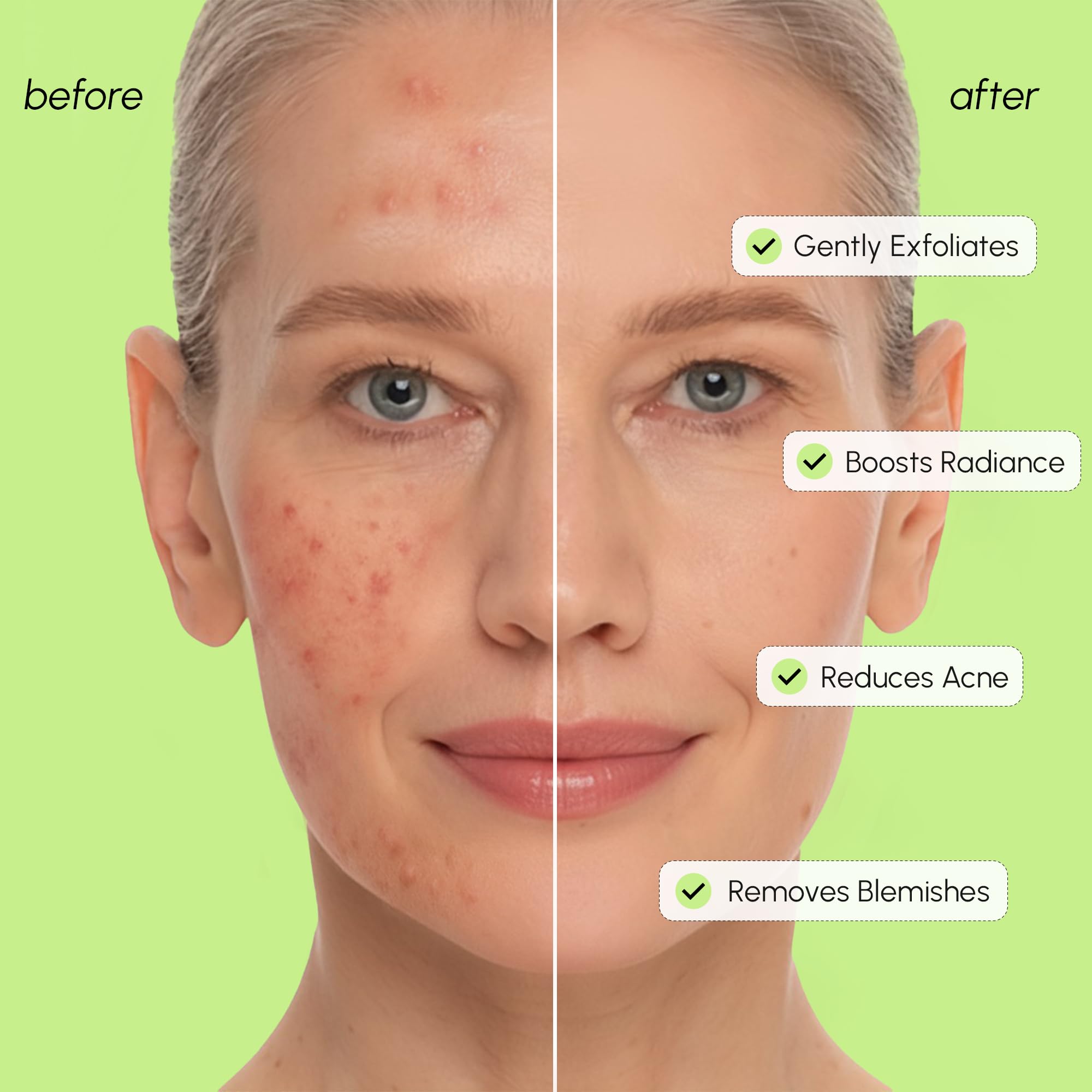 MAREE Pore-care close-up emphasizing pore refinement