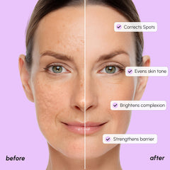 MAREE Serum corrección decoloración: manchas superficiales se vuelven más tenues.