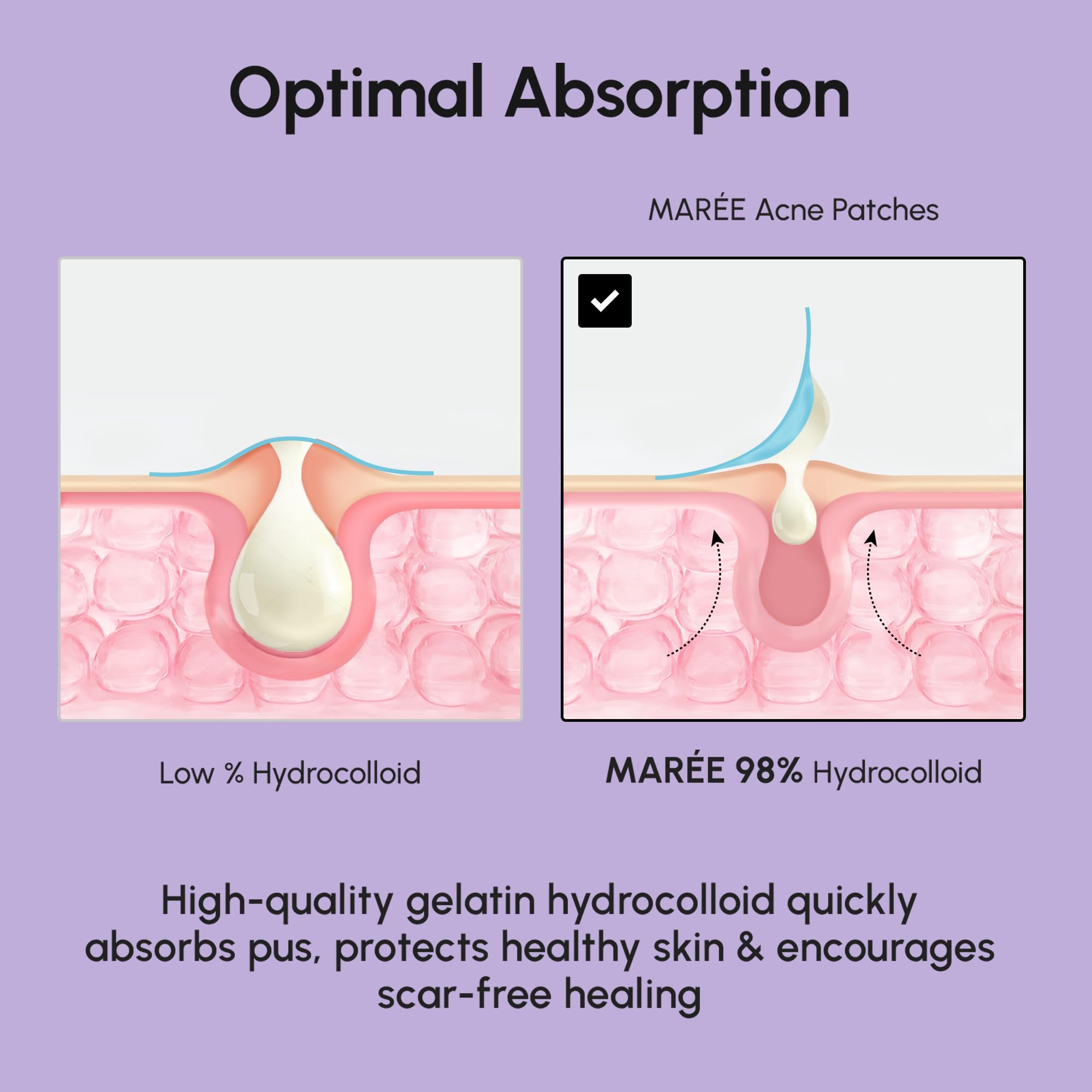 Star on skin representation of MAREE patches