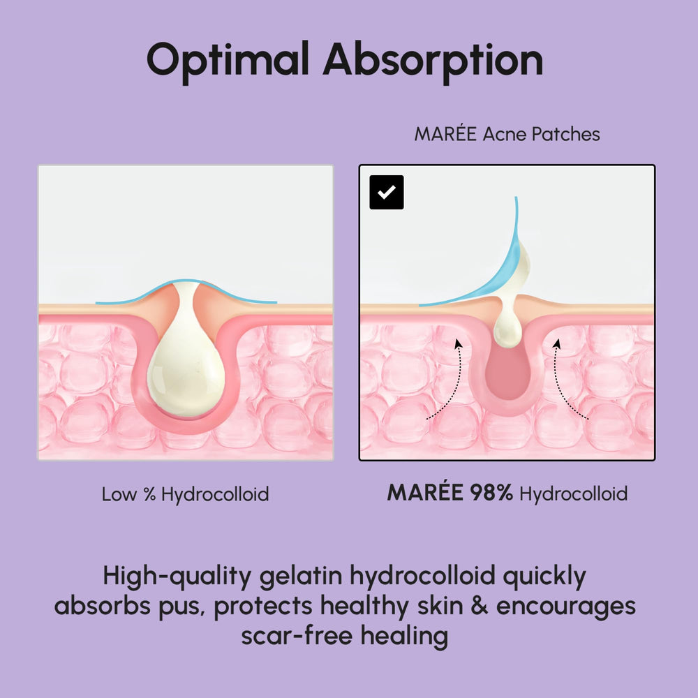 Star on skin representation of MAREE patches