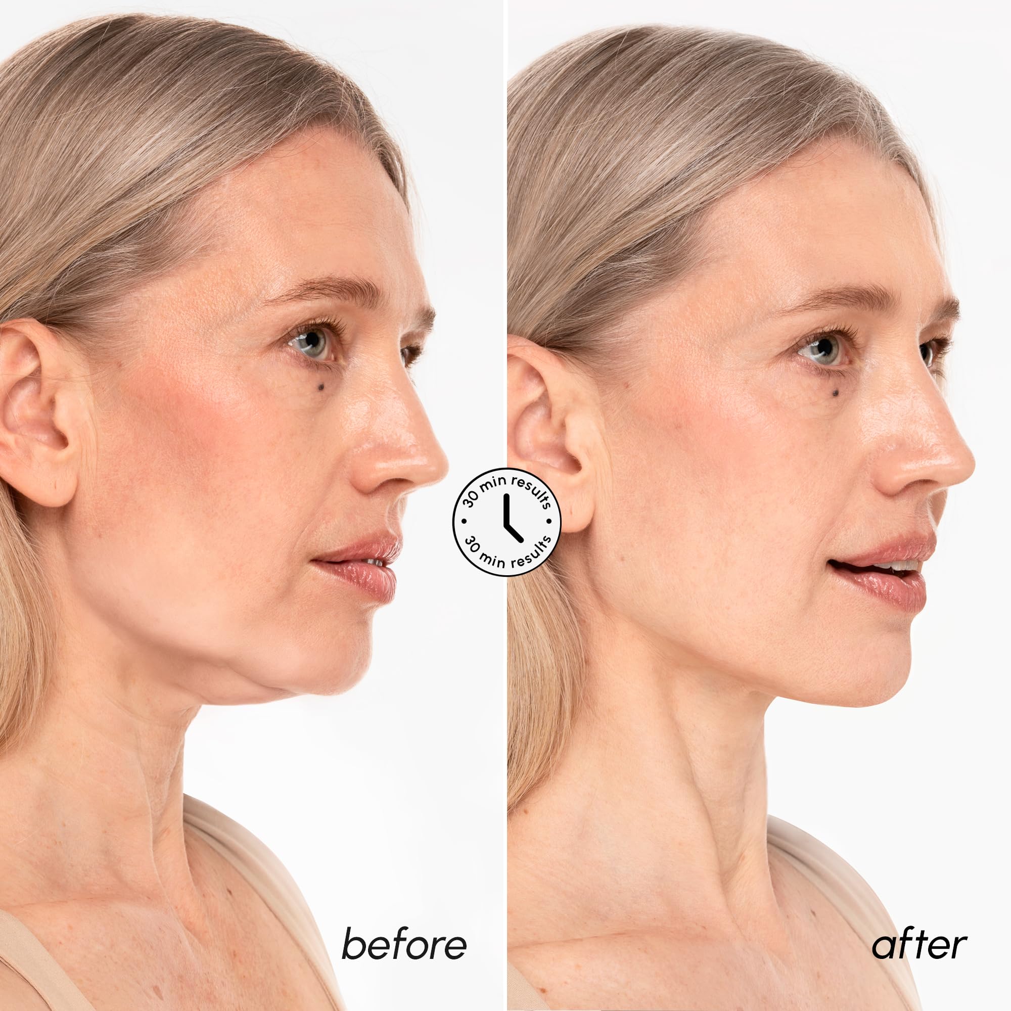 MAREE V Line Lifting Mask jawline definition through hydrogel fit.