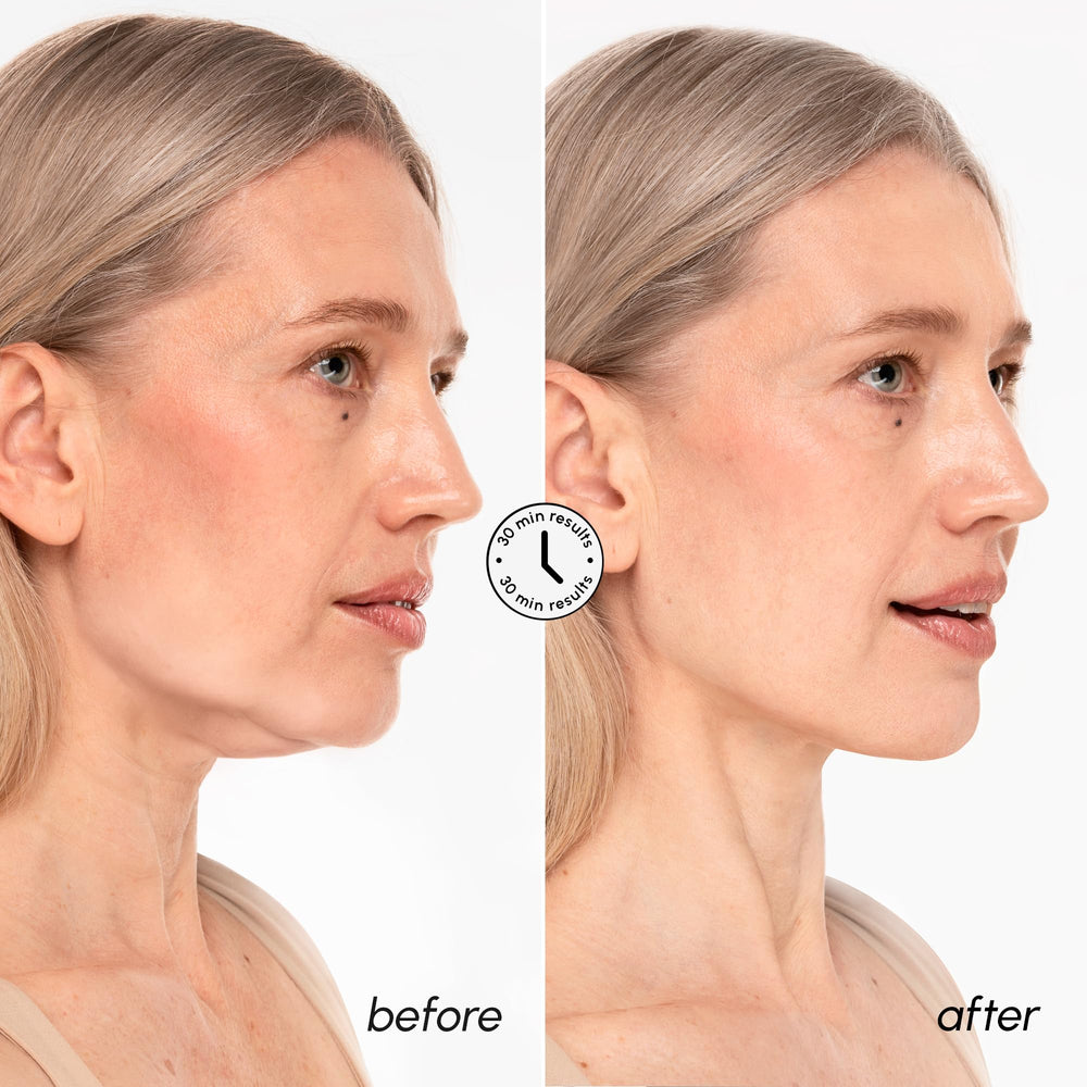 MAREE V Line Lifting Mask jawline definition through hydrogel fit.