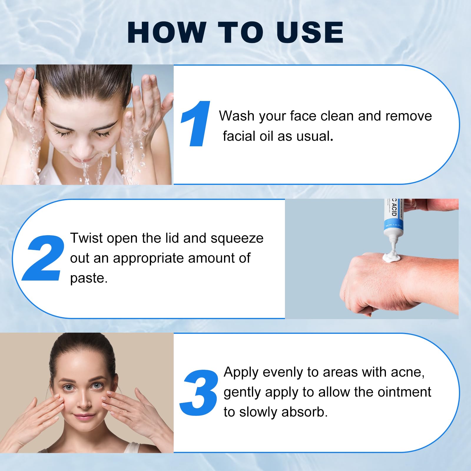 Marianp Azelaico 10% crema ayuda a reducir pigmentación facial