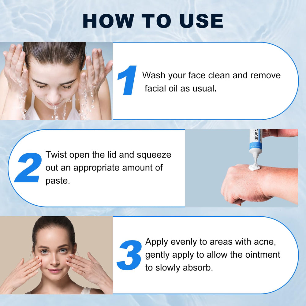 Marianp Azelaico 10% crema ayuda a reducir pigmentación facial