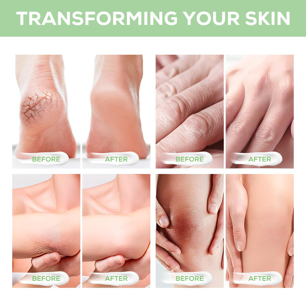 Mariayu Urea Cream 40% with aloe vera and jojoba — nourishes skin