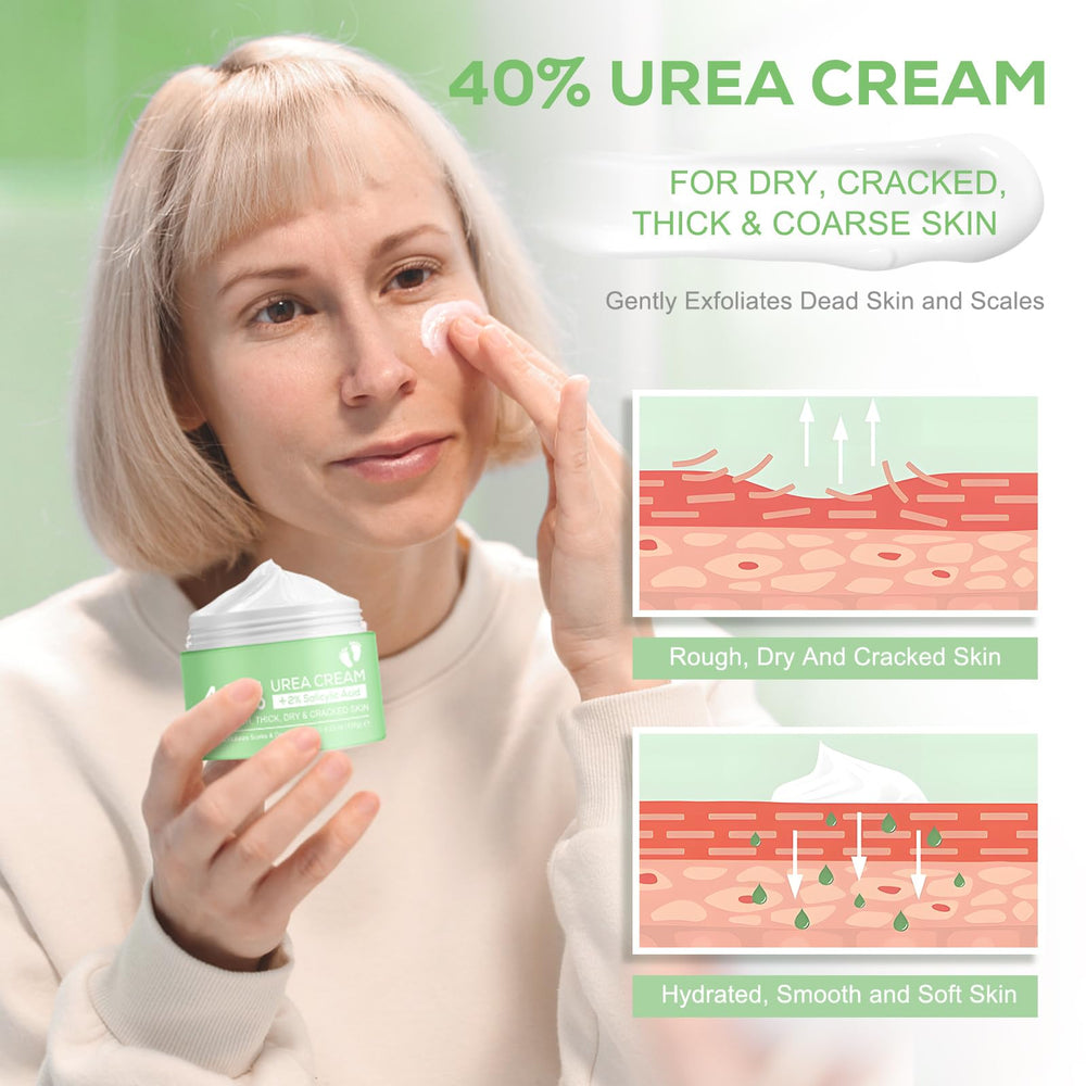 Mariayu Urea Cream 40% on feet — softens cracked heels gently