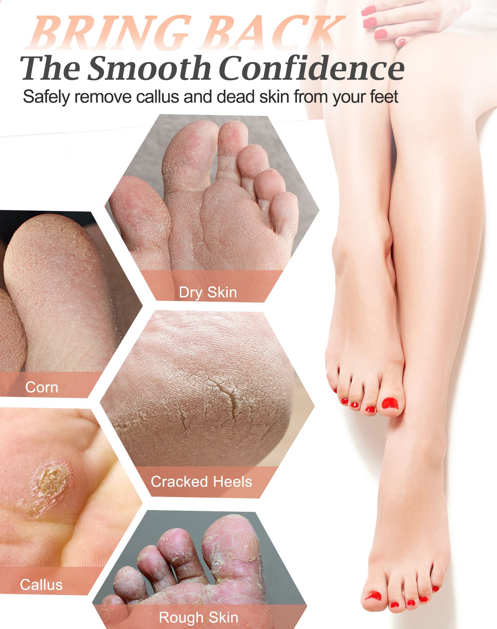 Maryton pumice stone targets calluses on hands and feet for smoother skin.