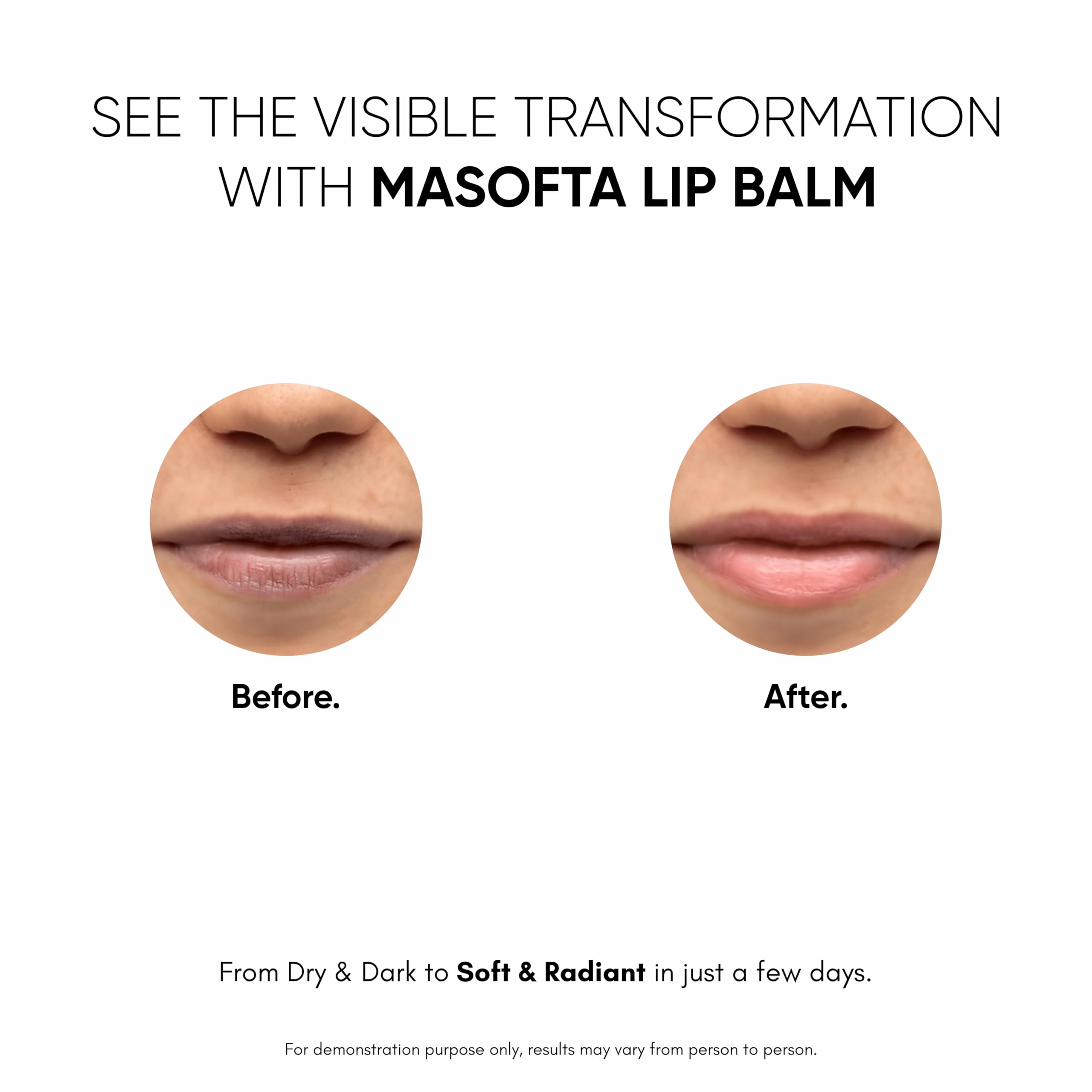 Masofta labial suavidad y comodidad sin resequedad