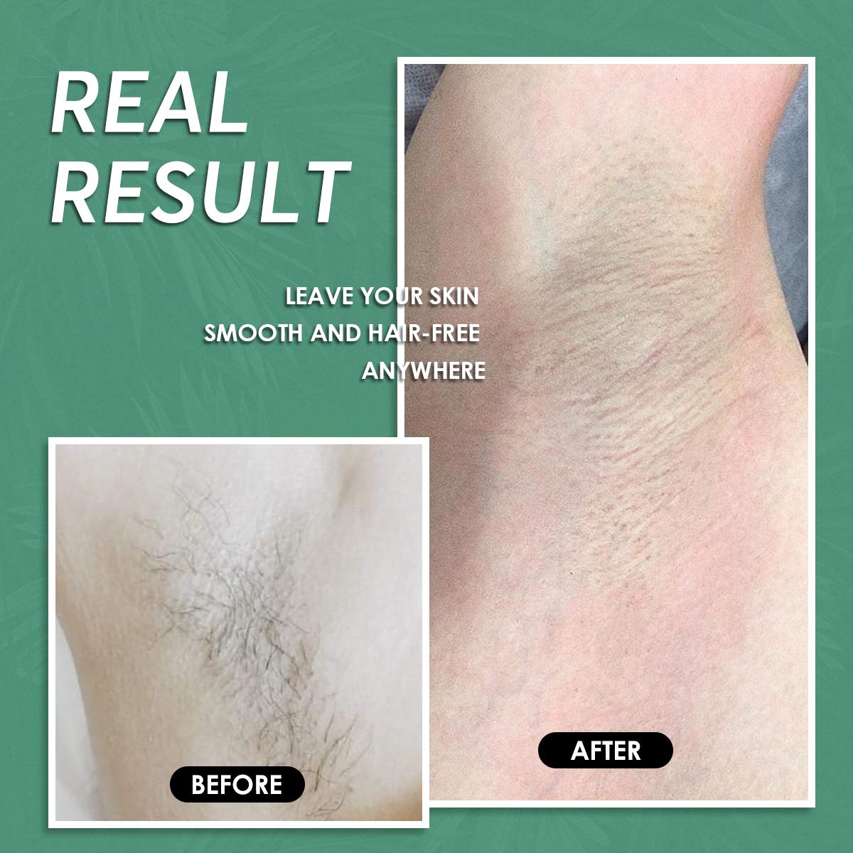 Maxpearl at-home waxing session with beads for Brazilian and other areas.