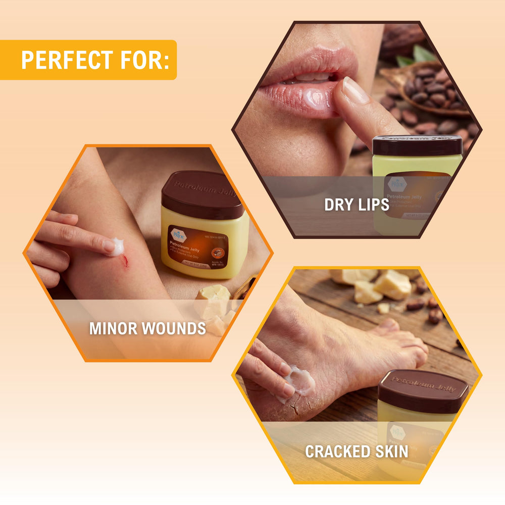MED PRIDE Cocoa Butter Petroleum Jelly helps cracked hands stay nourished.