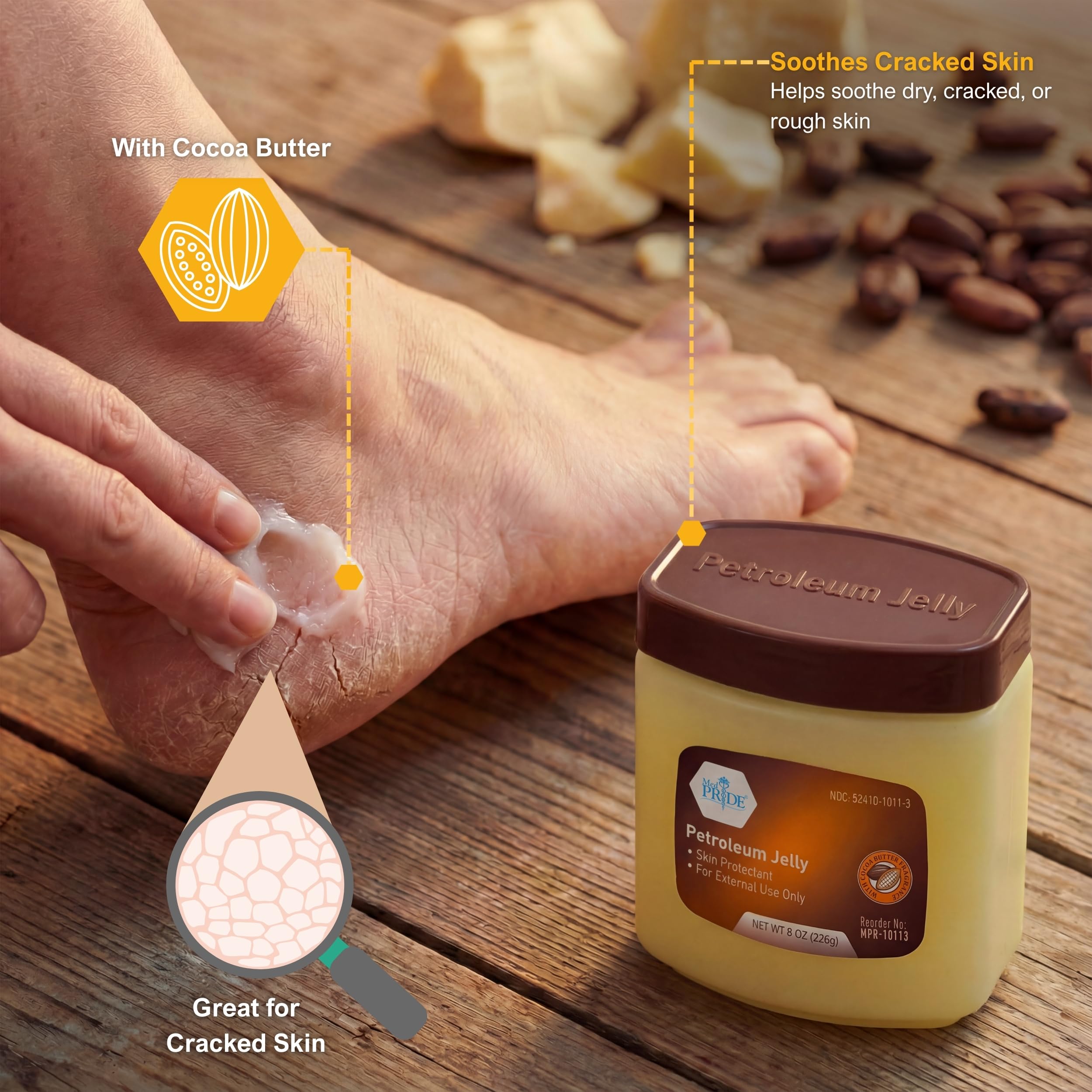 MED PRIDE Cocoa Butter Petroleum Jelly eases dry skin on hands and elbows.