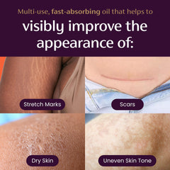 Mederma Quick Dry Oil hydrates dry skin with a light non greasy finish
