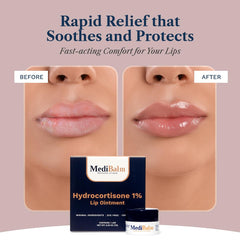 MediBalm ingredients: coconut oil and shea butter nourish lips.