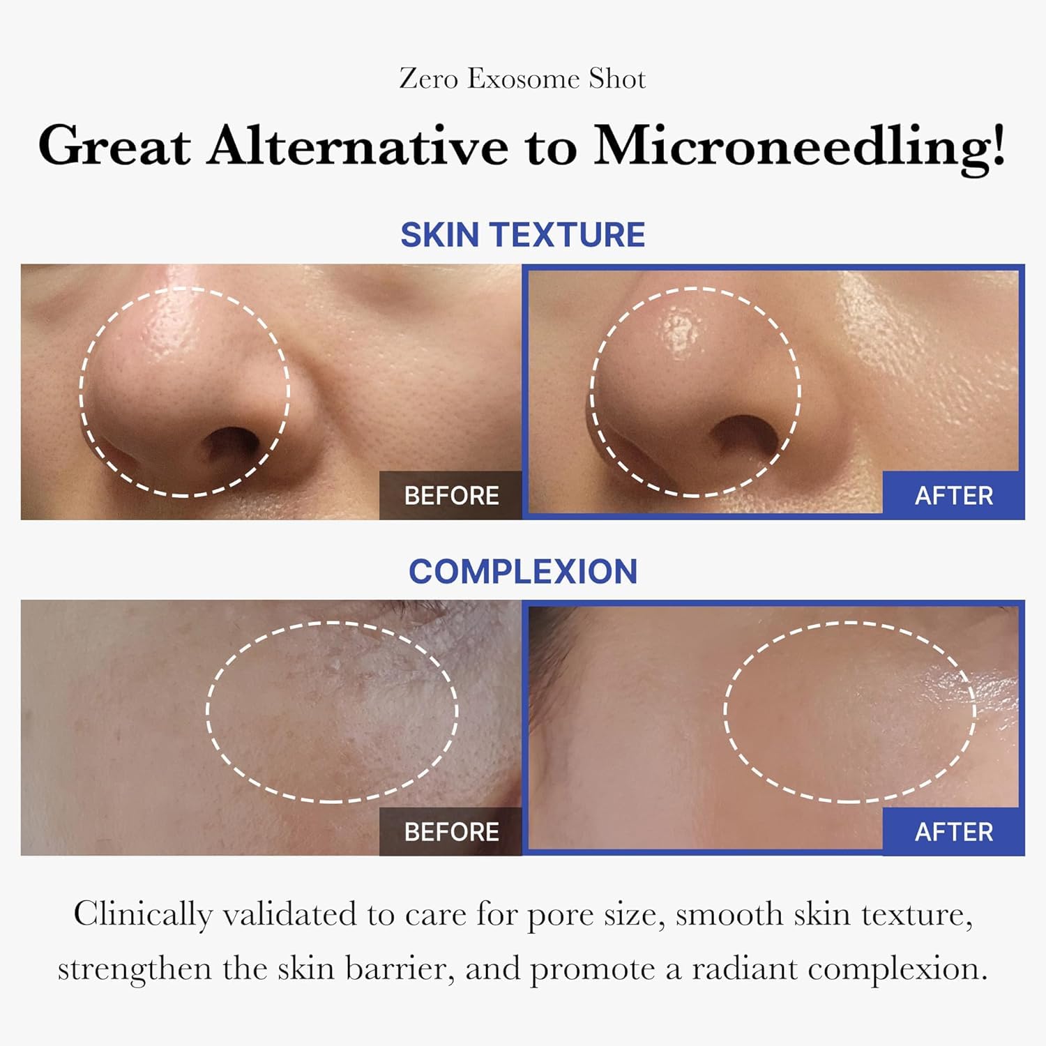 Medicube Exosome Shot absorbcion-mejorada: hidratación profunda visible