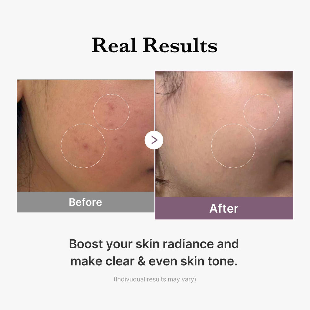 Medicube Age-R Glutathione Glow Toner, péptidos para firmeza y luminosidad.