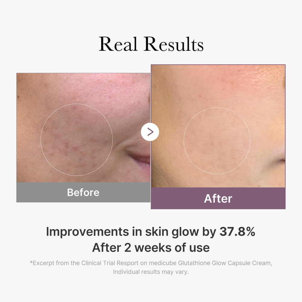 Medicube AGE-R packaging hints at premium Korean skincare ritual.