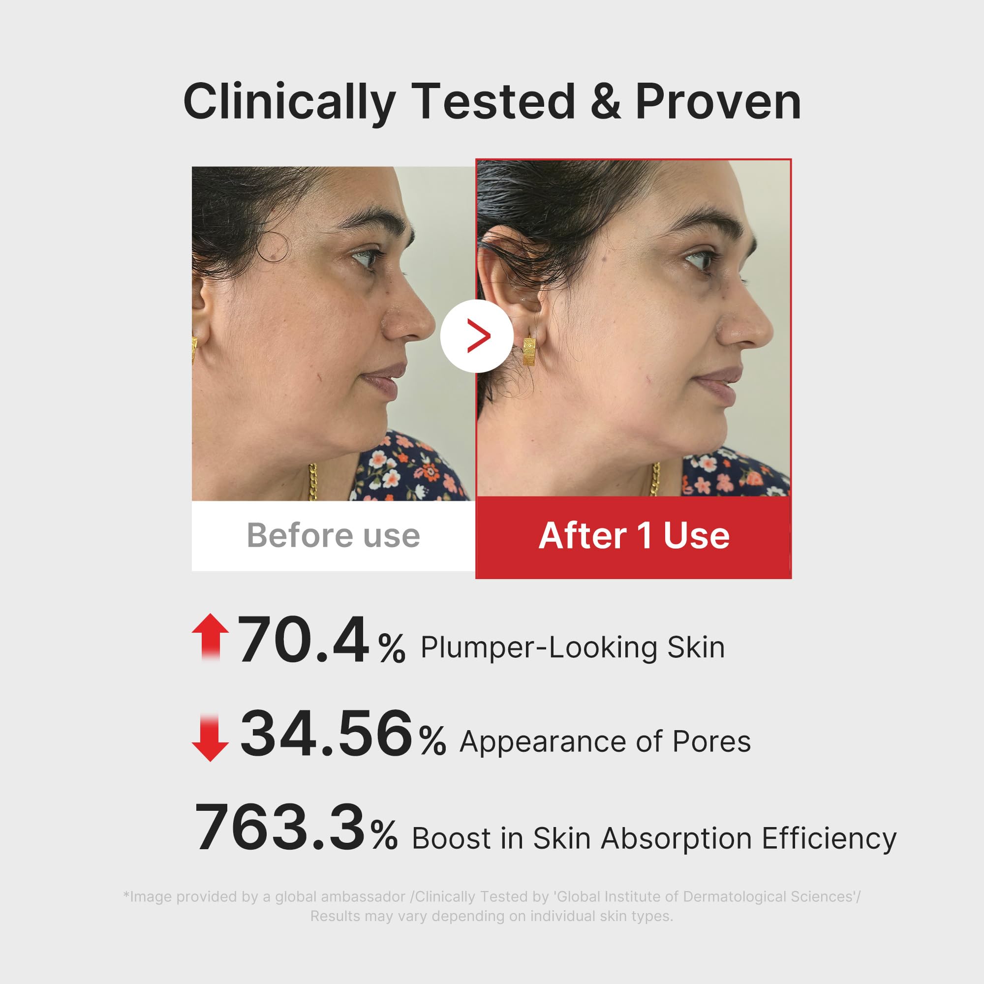 Medicube Booster Pro pore care frame highlighting refined pores.