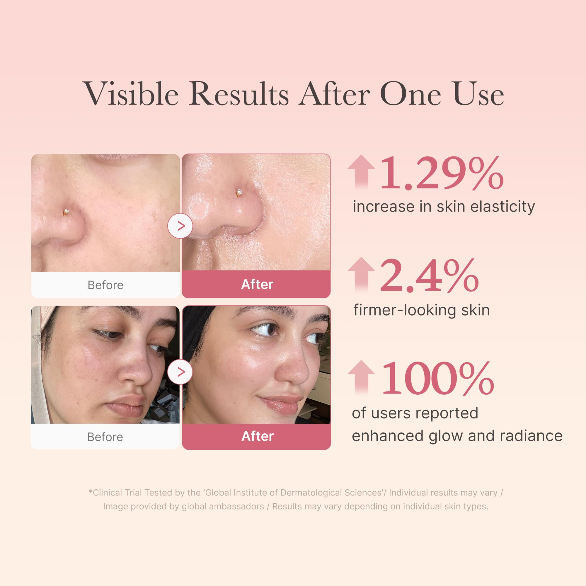 Niacinamida fortalece la barrera cutánea con Medicube Jelly Cream.
