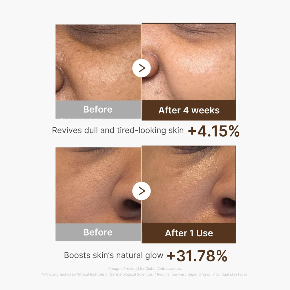 Medicube Deep Vitamin C Capsule Serum, contiene agua de Hippophae para revitalizar la piel.