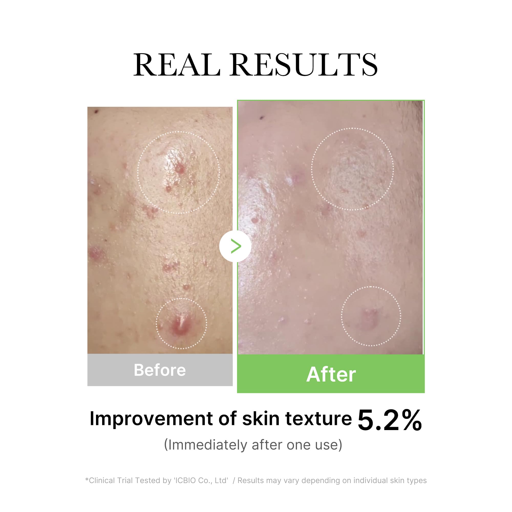 Medicube Exosome Cica Tea Tree Ampoule evening routine for calming care.