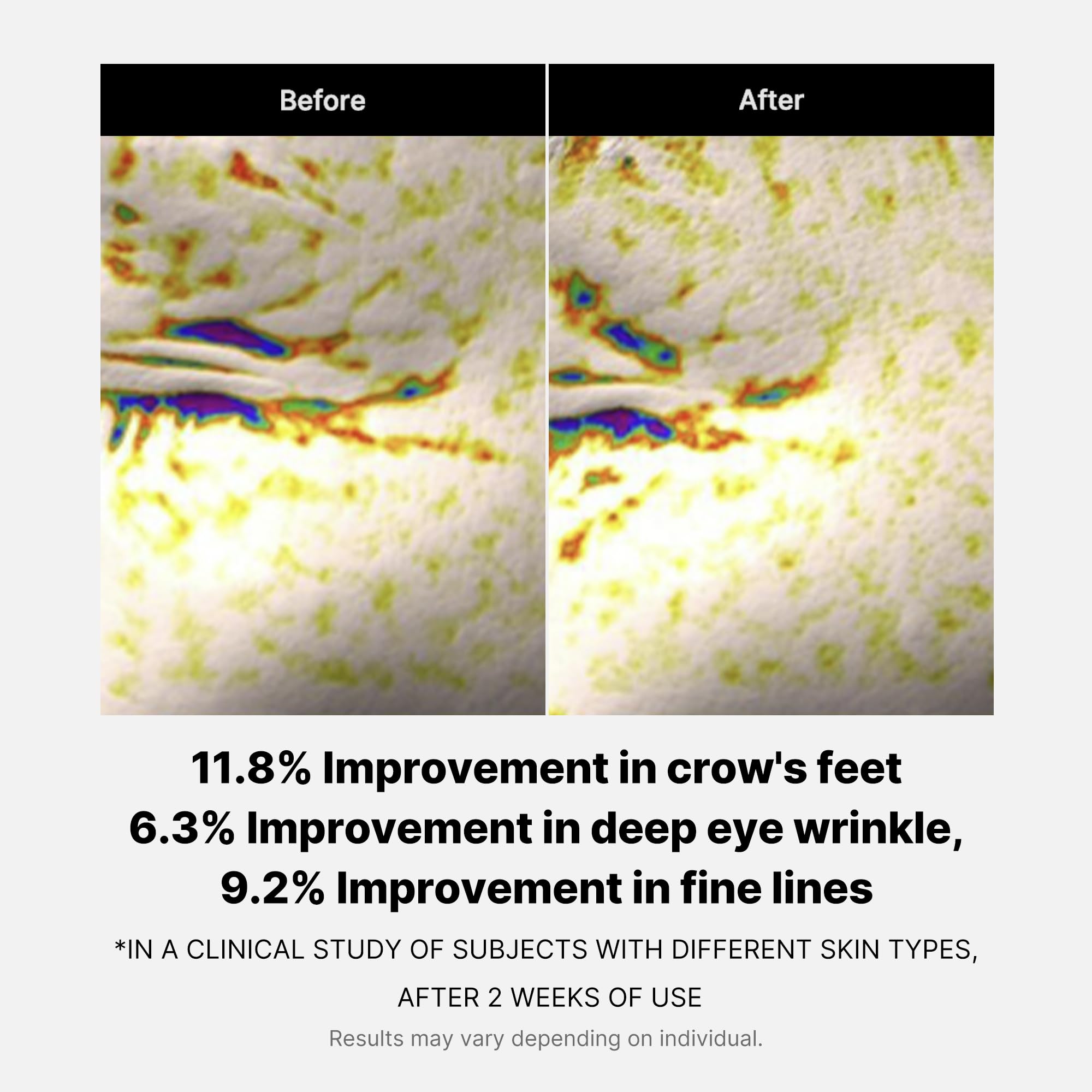 Medicube eye serum used in routine with moisturizer and sunscreen.