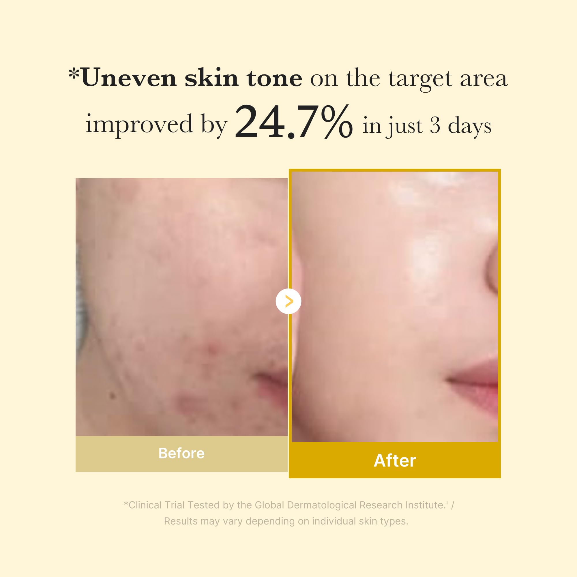 Medicube Kojic Acid Turmeric Overnight Wrapping Mask drying layer demonstrates overnight treatment