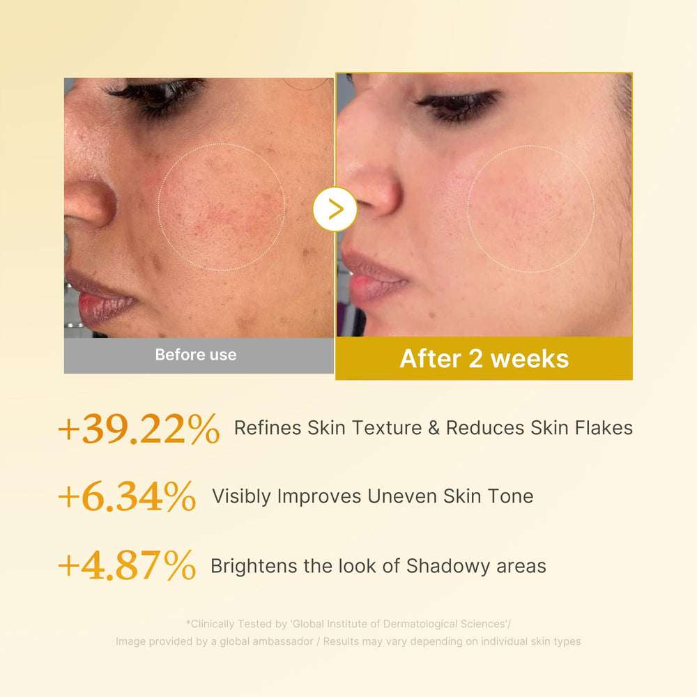 Medicube Kojic Acid Turmeric Toner applied on face shows even tone and refreshed glow.