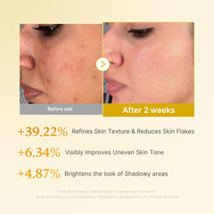 Medicube Kojic Acid Turmeric Toner applied on face shows even tone and refreshed glow.