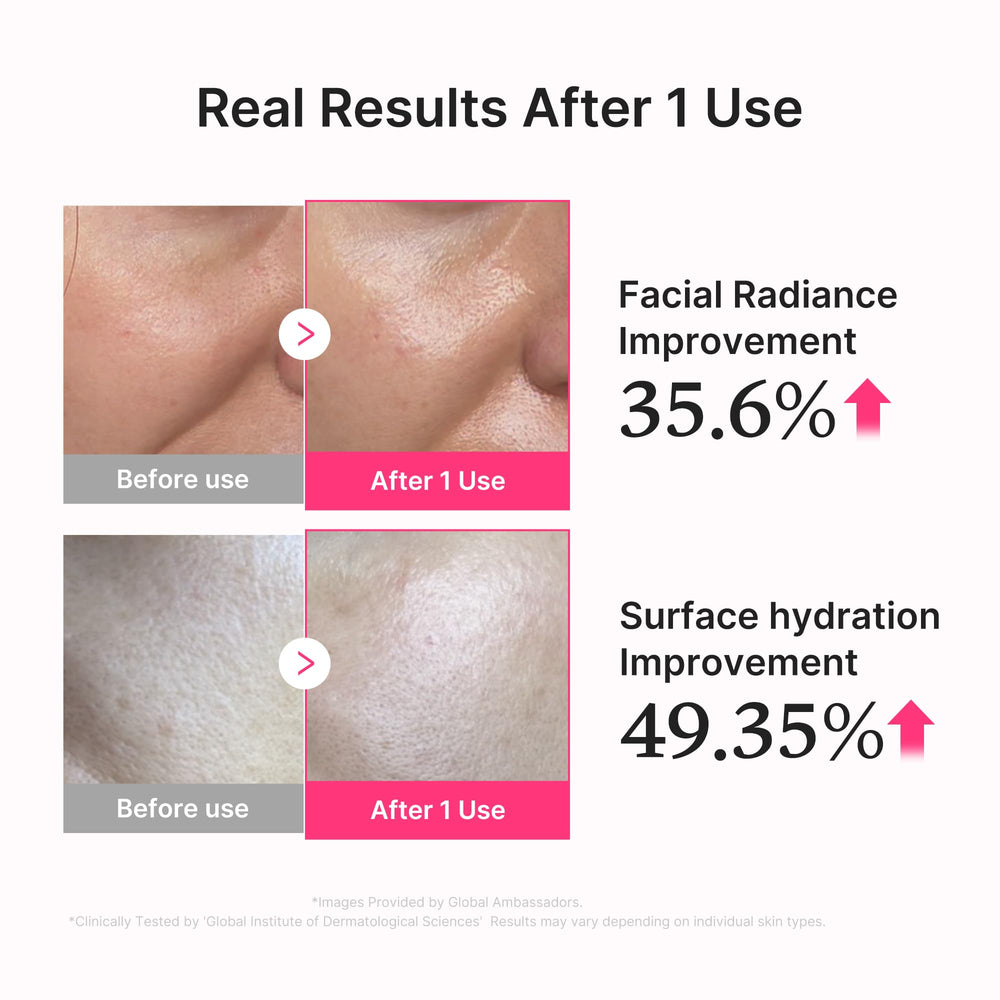 Medicube PDRN rosa suero con 5% niacinamida refina tono y textura.