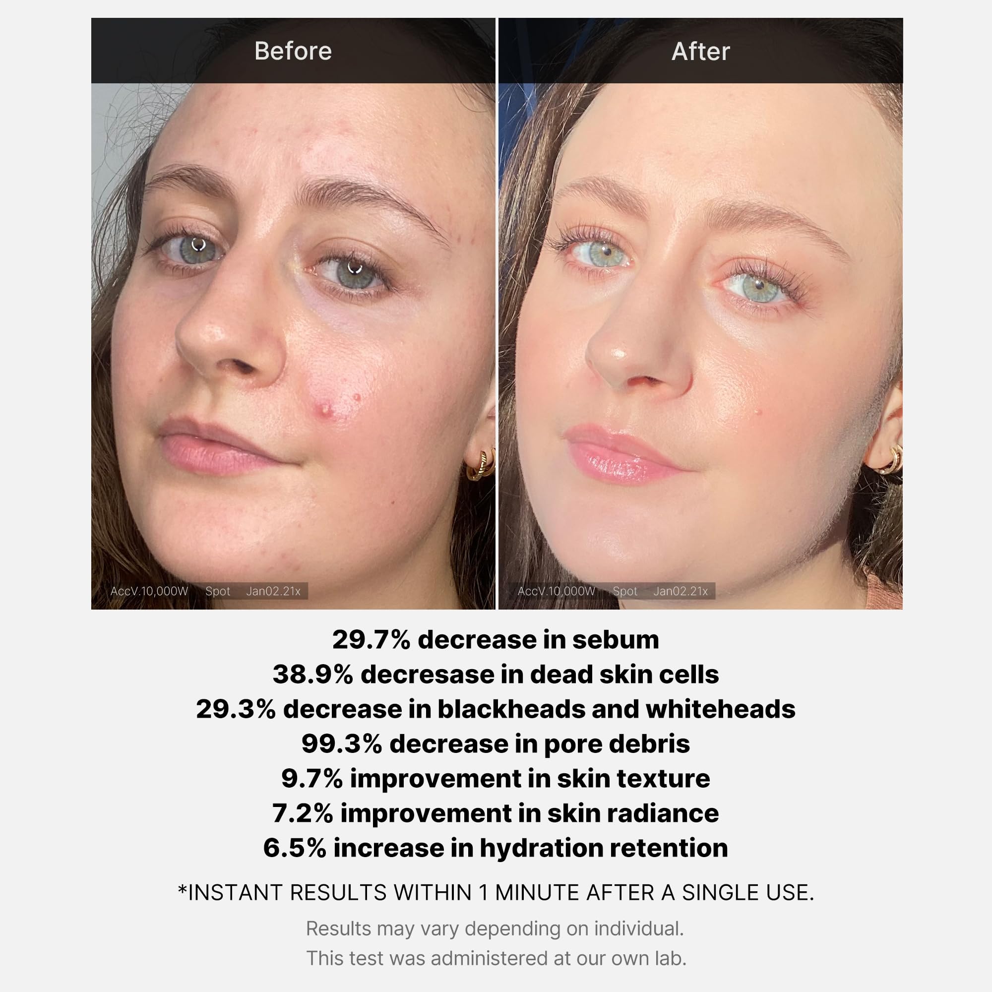 Protección de ingredientes calmantes para piel sensible durante exfoliación.