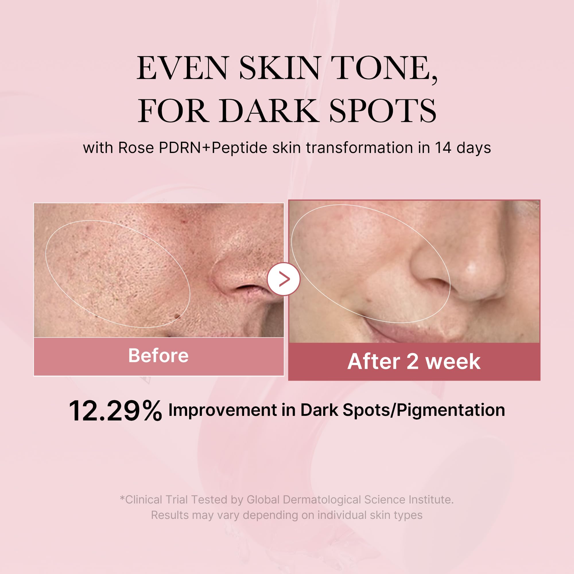 Medicube Rose PDRN Toner, etiqueta rosa, facilita una preparación suave de la piel.