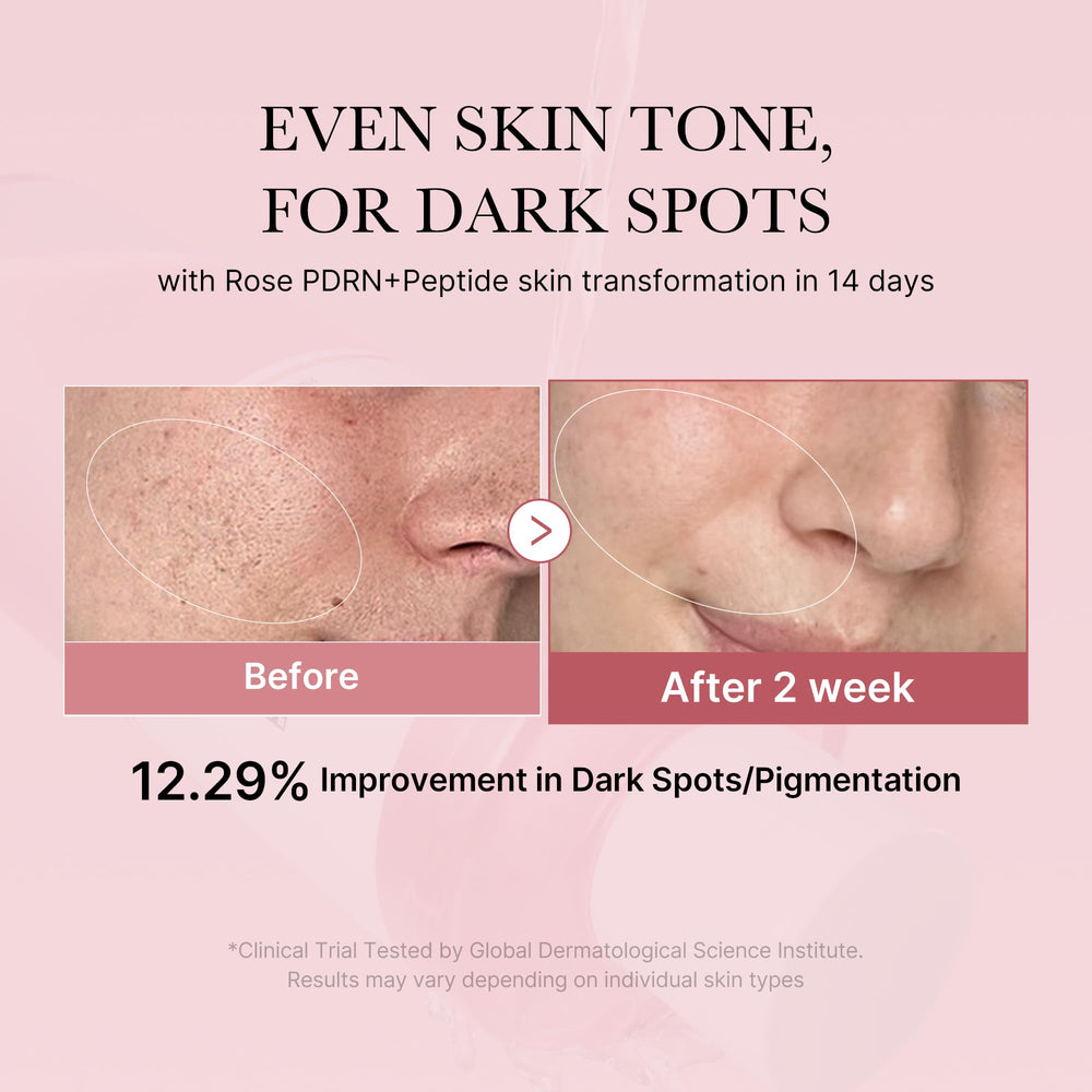 Medicube Rose PDRN Toner, etiqueta rosa, facilita una preparación suave de la piel.