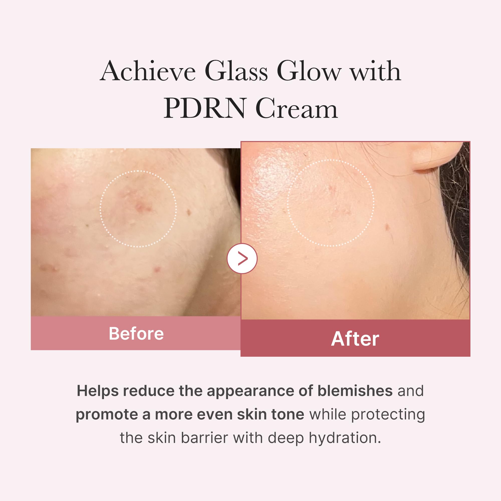 Medicube Salmon DNA PDRN crema textura ligera, absorción rápida y sin grasa.
