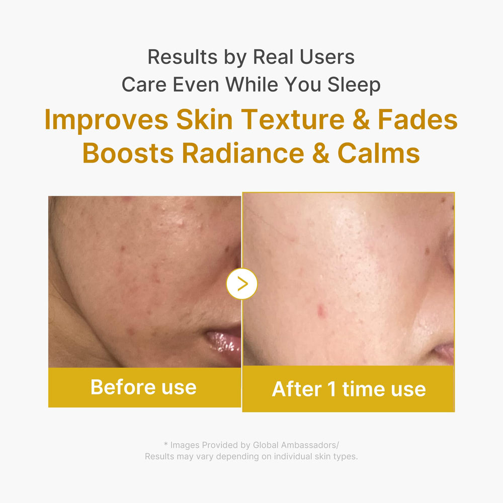 Medicube Wrapping Mask turmeric-rich texture highlights natural brightening.