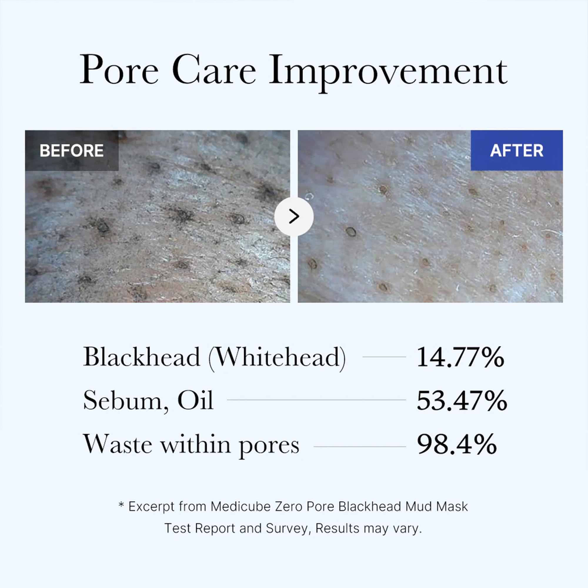 Enfriamiento de la piel con Medicube Zero Pore tras aplicar la máscara
