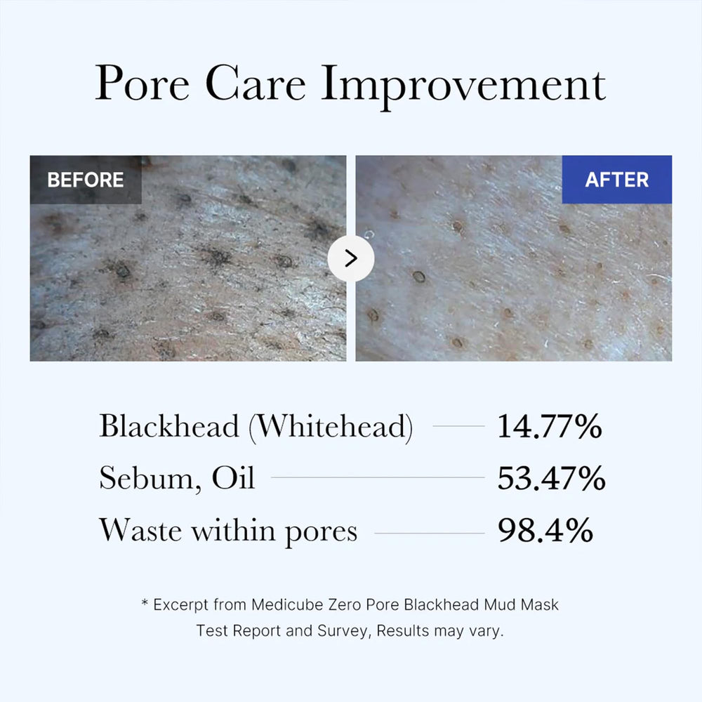 Enfriamiento de la piel con Medicube Zero Pore tras aplicar la máscara