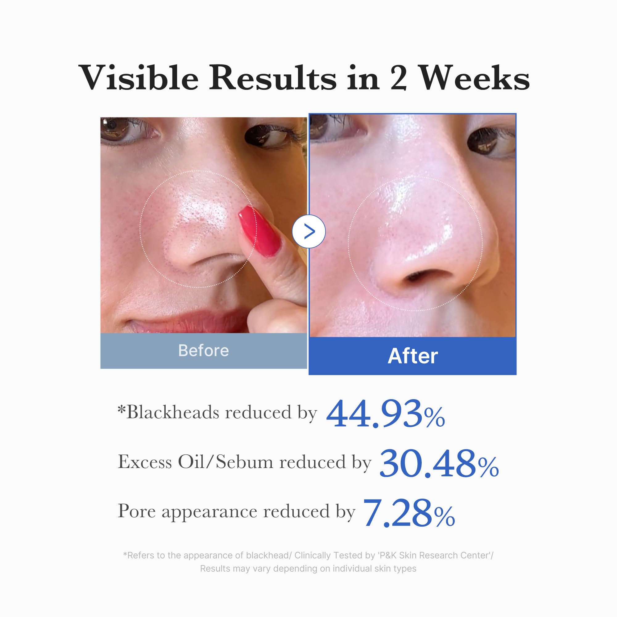 medicube Zero Pore Pad 2.0 70 pads count displayed clearly for value.