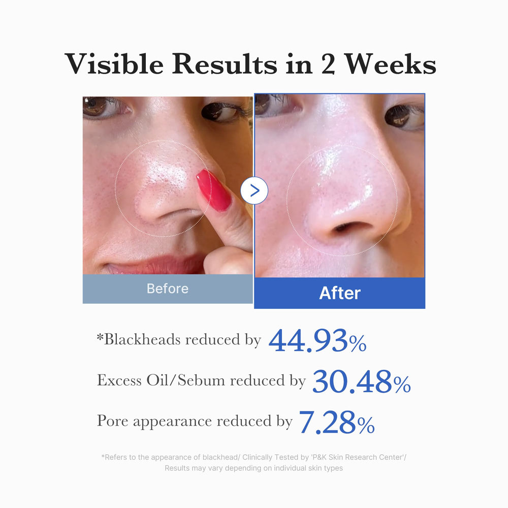 medicube Zero Pore Pad 2.0 70 pads count displayed clearly for value.