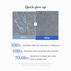 Discos Medicube Zero Pore Peel, lado microfibra para pulir zonas difíciles.