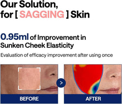 Mediheal discos tonificantes antienvejecimiento para elasticidad visible.