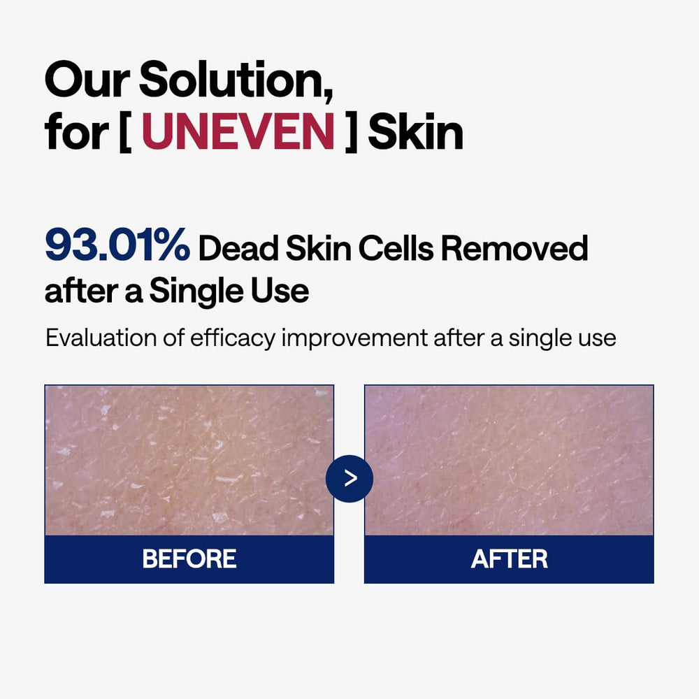Mediheal papaya enzyme close-up highlighting natural exfoliation ingredients.